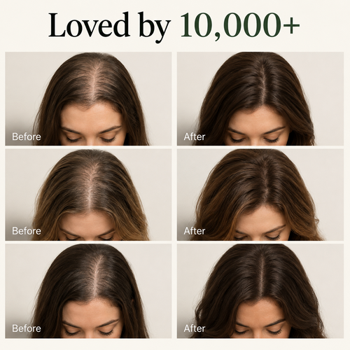 Elovia™ Korean Scalp Revival Bar